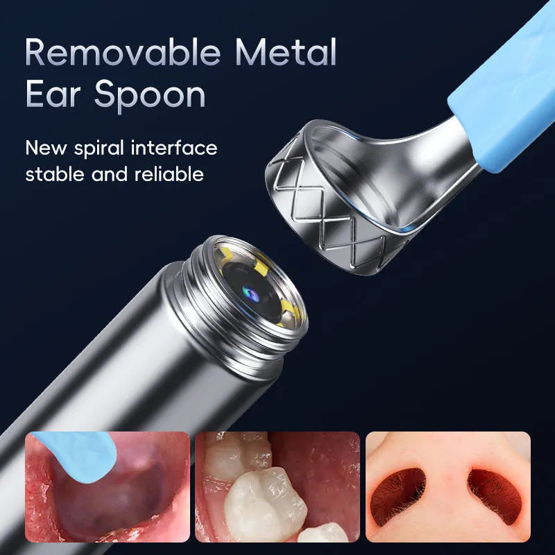Ear Wax Removal Tool with LED Light, Earwax Removal Endoscope, Ear Scope Camera, 1080P FHD Wireless