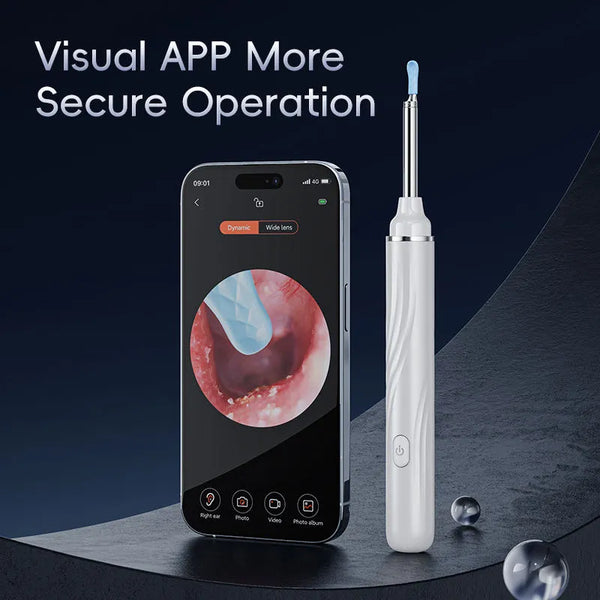 Ear Wax Removal Tool with LED Light, Earwax Removal Endoscope, Ear Scope Camera, 1080P FHD Wireless