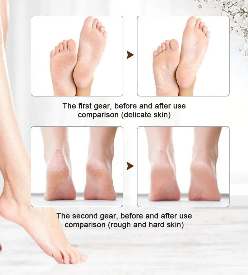 Rechargeable Flawless Pedi Foot Filer – Professional Electric Callus Remover & Dead Skin Peeler