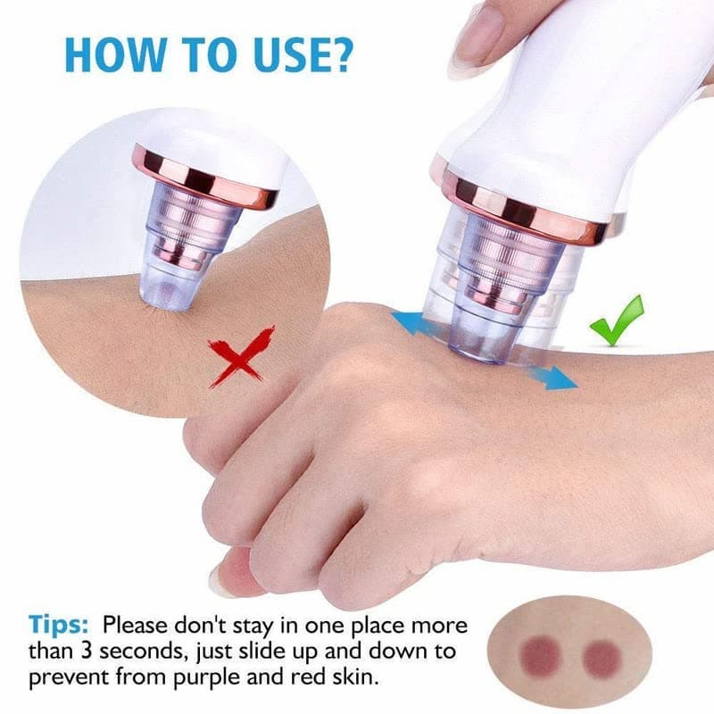 Rechargeable 5 in 1 Multifunctional Black Head Removal Machine